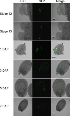 Loss of linker histone H1 in the maternal genome influences DEMETER-mediated demethylation and affects the endosperm DNA methylation landscape